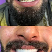 دندانپزشکی سپید|خدمات آرایشگری و زیبایی|تبریز, |دیوار