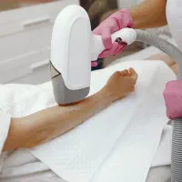 لیزر موهای زائد خانم و آقا