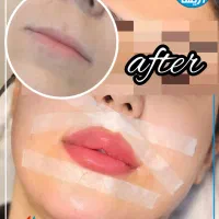 تخفیف ویژه خدمات پوست و مو به مناسبت روز  پزشک