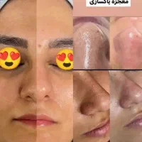 خدمات اصلاح و پاکسازی فیشال با قیمت باورنکردنی