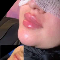 نیازمند مدل