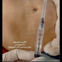 مدل ژل وبوتاکس