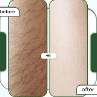آموزش نخ لیفت فیلر ژل بوتاکس لیزر مو فشیال طب سنتی|خدمات آموزشی|اصفهان, مرداویج|دیوار