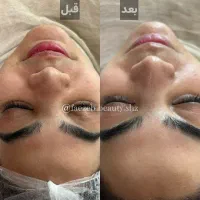 مدل فیشیال با تخفیف بابرند اکلادو