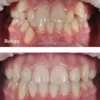 تولید محتوا حضوری کلینیک دندانپزشکی
