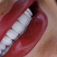 خدمات دندانپزشکی