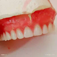 ساخت دندان مصنوعی