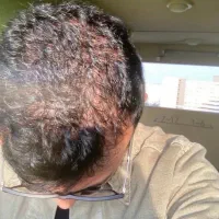 مثل‌ آب خوردن موهاتو در بیار