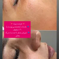 اموزش تخصصی وخصوصی پوست