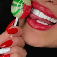 بهترین و زیباترین لمینت دندانپزشکی اقساط