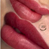 رفع کبودی لب با شیدینگ تخصصی