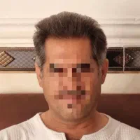 جشنواره کاشت مو|خدمات آرایشگری و زیبایی|شیراز, قصرالدشت|دیوار