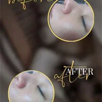 پاکسازی تخصصی پوست، تغییر از جلسه اول|خدمات آرایشگری و زیبایی|قم, انصارالحسین|دیوار