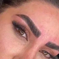 فیبروز ابرو