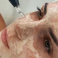 آموزش پردرآمد ترین لاین های پوست و مو لیزر پاکسازی|خدمات آموزشی|اهواز, نادری|دیوار