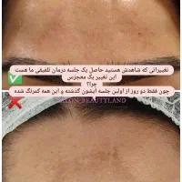 فیشال تخصصی پوست آقایان و بانوان|خدمات آرایشگری و زیبایی|گلبهار, شهر جدید گلبهار|دیوار