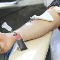 فصد پیشانی حجامت زالو درمانی|خدمات آرایشگری و زیبایی|ارومیه, |دیوار