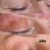 پزشکی آف ویژه|خدمات آرایشگری و زیبایی|بروجرد, |دیوار