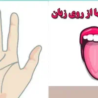 تشخیص عارضه ها ازروی عکس زبان