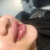 ژل لب و کاشت ناخون