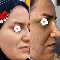 پاکسازی کبد و معده ،ریزش مو ، لک های پوستی|خدمات آرایشگری و زیبایی|آمل, |دیوار