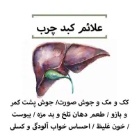 کبد چرب