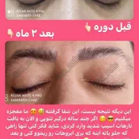 مژه و ابرو طبیعی خود را از ما بخواهید|آرایشی، بهداشتی، درمانی|یاسوج, |دیوار