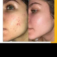 ژل گیاهی جوانسازی ضدلک ضدجوش ضدکک مک|آرایشی، بهداشتی، درمانی|بروجرد, |دیوار