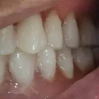 نیروی کار جهت لابراتوار دندانسازی