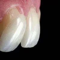 مرکز کامپوزیت، لمینت و ایمپلنت دکتر صبا صباغی|خدمات آرایشگری و زیبایی|شیراز, تاچارا|دیوار