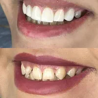 آموزش حرفه ای کار درمانی و زیبایی دندانپزشکی|خدمات آموزشی|تهران, مهرآباد جنوبی|دیوار