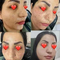 درمان تخصصی مشکلات پوست ومو