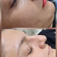 تخفیف در لاین فیشیال ومیکاپ