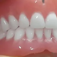 دندان مصنوعی دست دندان|خدمات آرایشگری و زیبایی|تهران, زیبادشت|دیوار