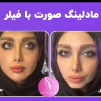 جشنواره لیزر مو تزریق ژل لب بوتاکس فیلر جوانساز|خدمات آرایشگری و زیبایی|تهران, صادقیه|دیوار