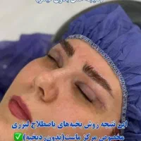 بلفاروپلاستی و ساکشن غبغب و سانترال لب