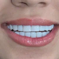 کامپوزیت نانو سرامیک با ضمانت