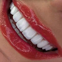 جشنواره دندانپزشکی با بالاترین کیفیت تخفیف