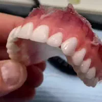 دندان مصنوعی با طرح لبخند و طراحی مینیاتوری