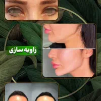 بلفارو/غبغب/سانترال/چشم گربه ایی/فیلر بادی و بکینی|خدمات آرایشگری و زیبایی|اهواز, کیانپارس |دیوار
