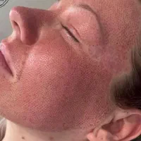 پلاسما جت. لیفت ولمینت ابرو و مژه|خدمات آرایشگری و زیبایی|اصفهان, خواجو|دیوار