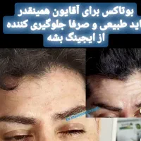 بوتاکس طبیعی درهرسنی|خدمات آرایشگری و زیبایی|رشت, بلوار گیلان|دیوار