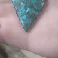پلاک گردنی