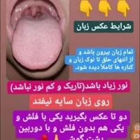 بیماریهای بدنت رو از روی عکس زبانت تشخیص میدم|فعالیت داوطلبانه|نوشهر, |دیوار