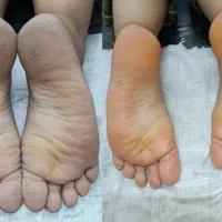 خدمات کفسابی پدیکور|خدمات آرایشگری و زیبایی|خرمآباد, |دیوار