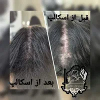 میکرو اسکالپ سر|خدمات آرایشگری و زیبایی|شیراز, اصلاح‌نژاد|دیوار
