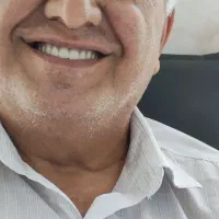 ساخت انواع پروتز های دندان مصنوعی|خدمات آرایشگری و زیبایی|کرج, برغان|دیوار