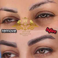 ریموو تخصصی تاتو و میکروبلیدینگ با رجووی|خدمات آرایشگری و زیبایی|زنجان, |دیوار