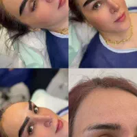 مرکز فوق تخصصی( کاشت مو ۱۴ م/کاشت ابرو ۱۰م)|خدمات آرایشگری و زیبایی|اندیشه, اندیشه فاز ۱|دیوار