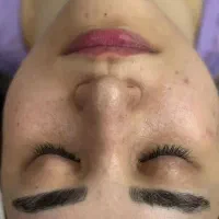 فیشال و پاکسازی صورت برای آقایان وبانوان